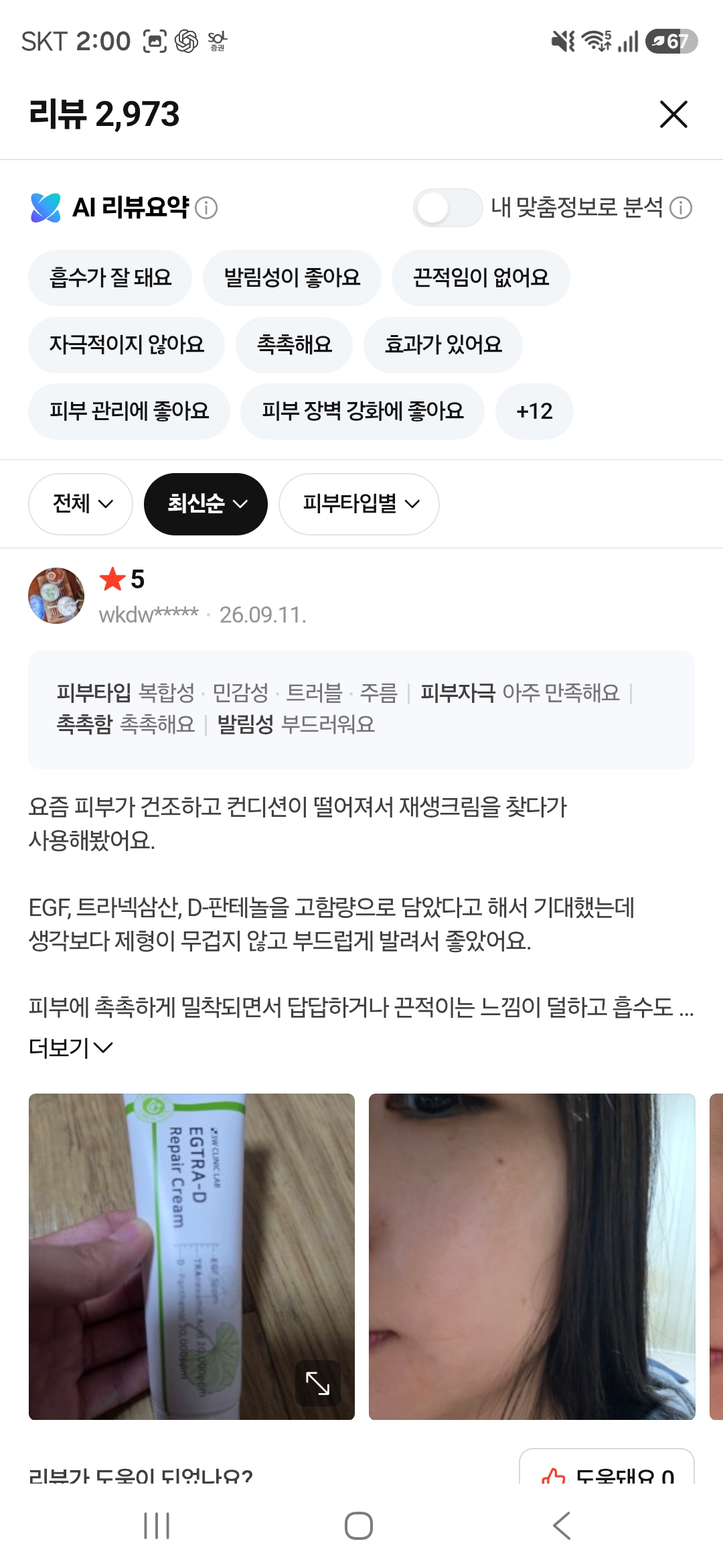 이지트라 고함량 트라넥삼산, D판테놀, EGF 재생크림 후기 모집