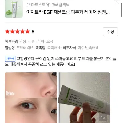 이지트라 고함량 트라넥삼산, D판테놀, EGF 재생크림 후기 모집