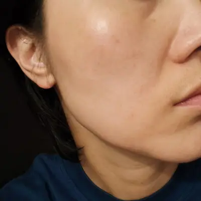 [나틴다] 솔잎 담은 진정 시카크림 100g